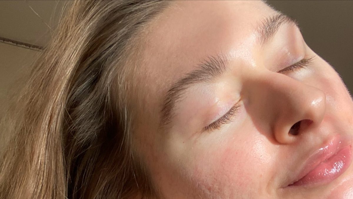 How to get rid of acne scars