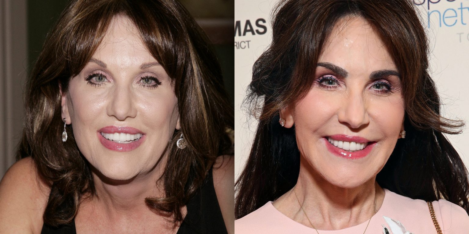 Fascinating How Did Robin Mcgraw Lose Weight Gallery