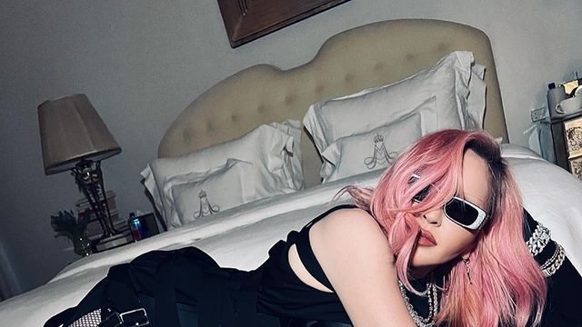 Madonna plastic surgery: her new face is shocking