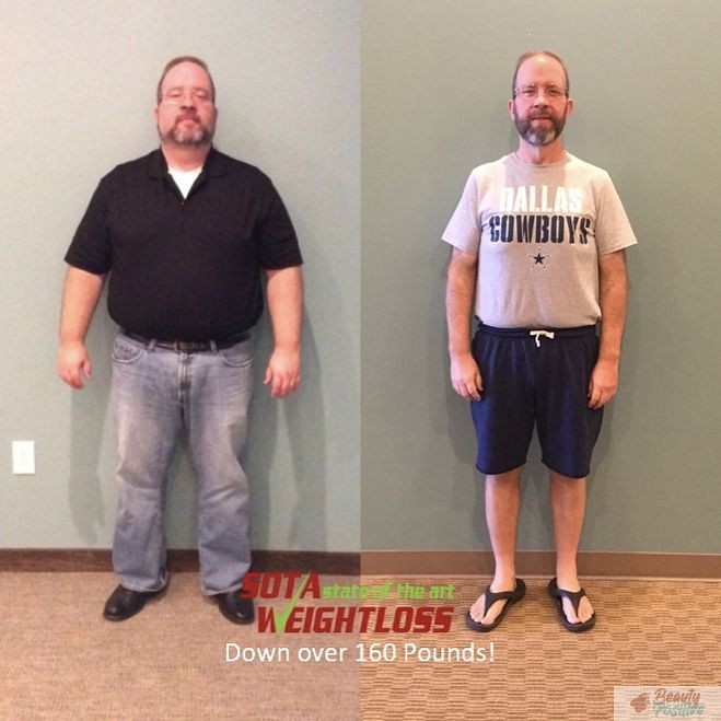 Soa weight loss results